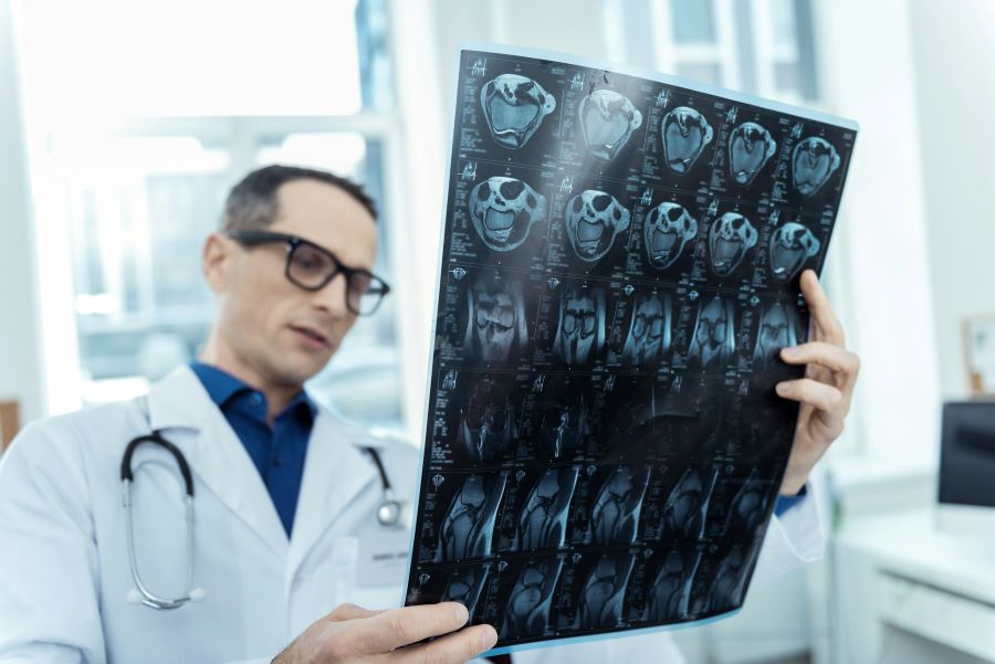 a doctor looking at a transparency of medical images