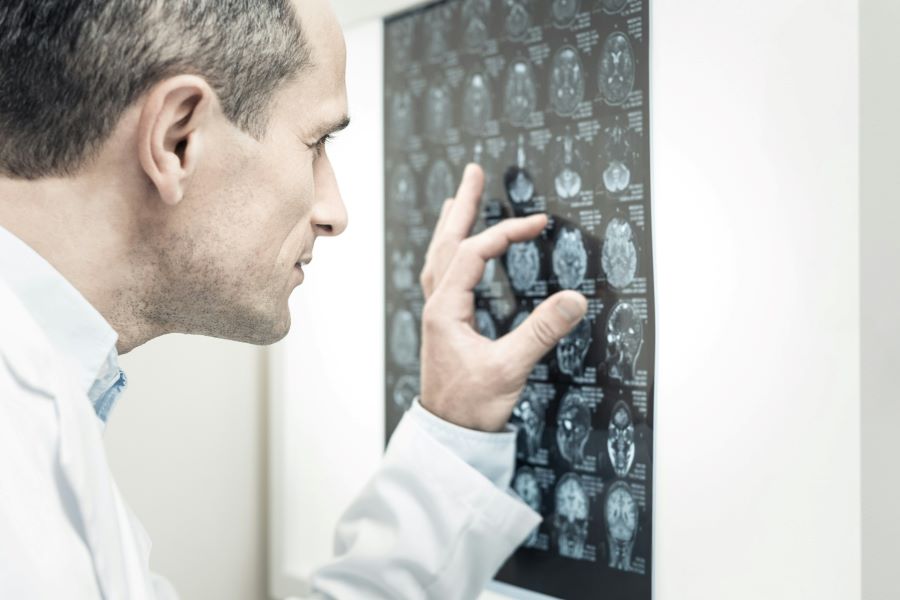 a doctor looking at brain mri images